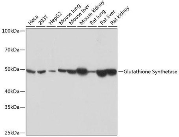 Metabolism Antibodies 3 Anti-Glutathione Synthetase Antibody CAB11557