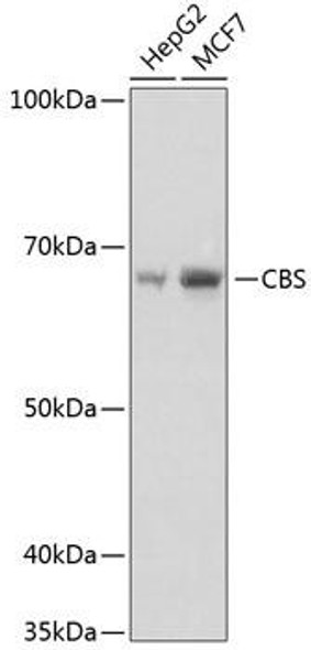 Metabolism Antibodies 3 Anti-CBS Antibody CAB11612