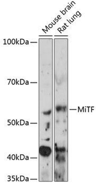 Epigenetics and Nuclear Signaling Antibodies 5 Anti-MiTF Antibody CAB11649