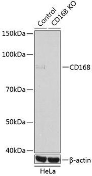 KO Validated Antibodies 1 Anti-CD168KO Validated Antibody CAB11666