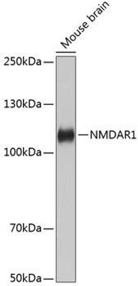 Signal Transduction Antibodies 3 Anti-NMDAR1 Antibody CAB11699