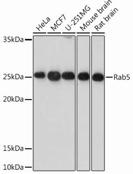 Cell Biology Antibodies 13 Anti-Rab5 Antibody CAB12304