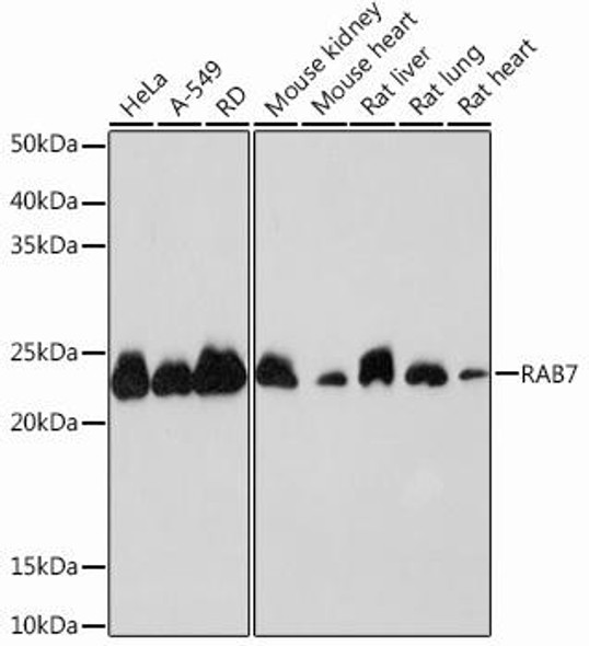 Autophagy Antibodies Anti-RAB7 Antibody CAB12308