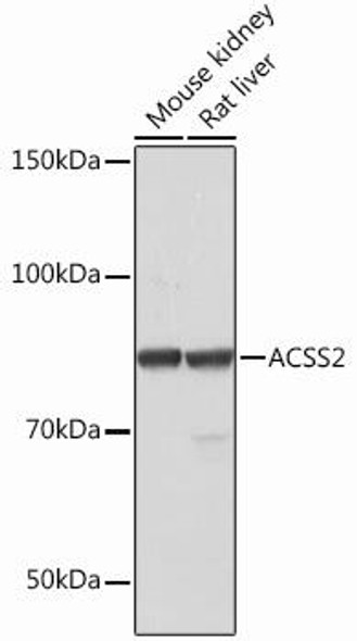 Cell Biology Antibodies 14 Anti-ACSS2 Antibody CAB12334
