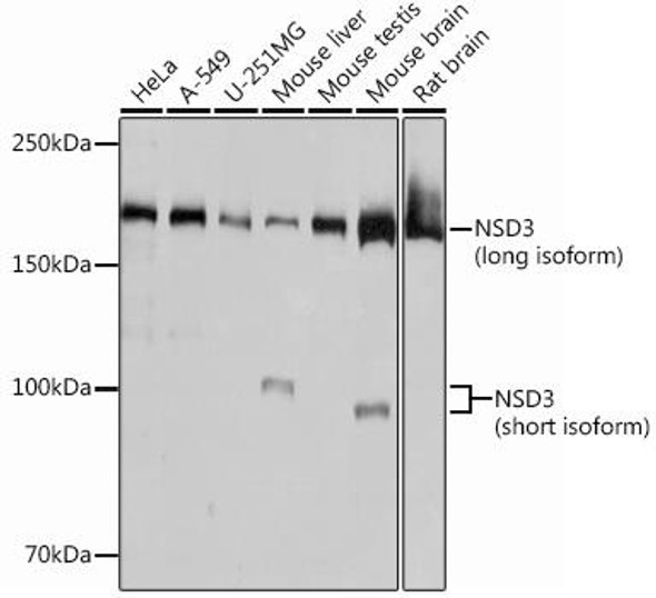 Epigenetics and Nuclear Signaling Antibodies 5 Anti-NSD3 Antibody CAB12342