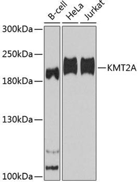Cell Biology Antibodies 14 Anti-KMT2A Antibody CAB12353