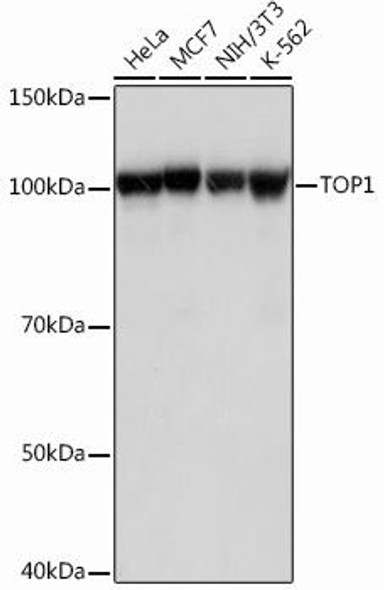 Cell Biology Antibodies 14 Anti-TOP1 Antibody CAB12409