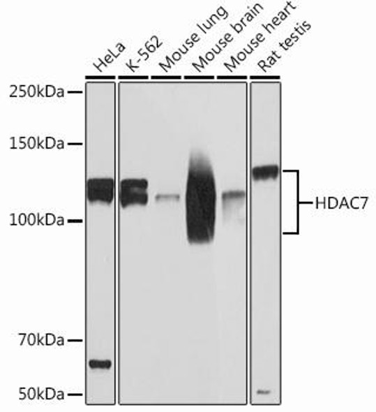 Epigenetics and Nuclear Signaling Antibodies 5 Anti-HDAC7 Antibody CAB13008