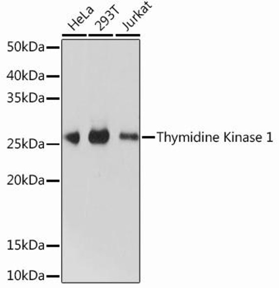 Epigenetics and Nuclear Signaling Antibodies 5 Anti-Thymidine Kinase 1 Antibody CAB13612