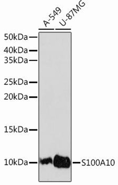 Cell Biology Antibodies 14 Anti-S100A10 Antibody CAB13614