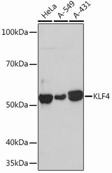 Epigenetics and Nuclear Signaling Antibodies 5 Anti-KLF4 Antibody CAB13673