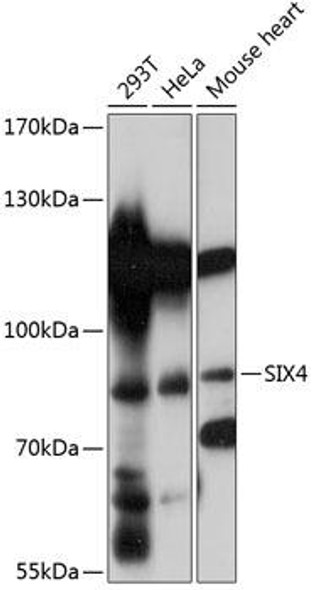 Cell Biology Antibodies 14 Anti-SIX4 Antibody CAB14406