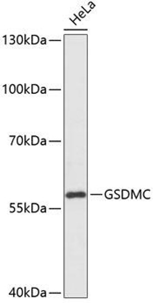 Cell Biology Antibodies 14 Anti-GSDMC Antibody CAB14550