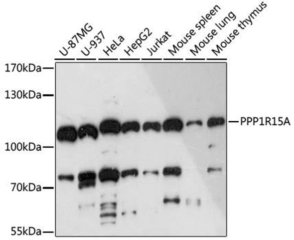 Cell Biology Antibodies 14 Anti-PPP1R15A Antibody CAB16260