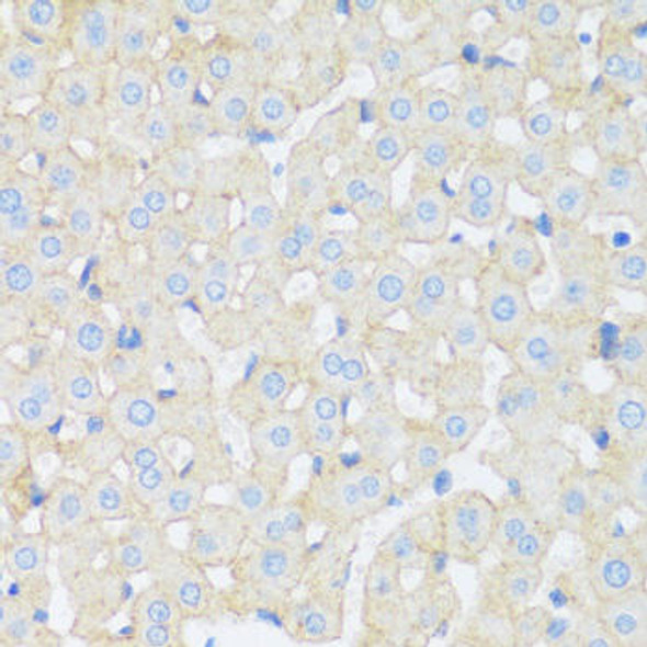 Cell Biology Antibodies 14 Anti-ASGR1 Antibody CAB16766