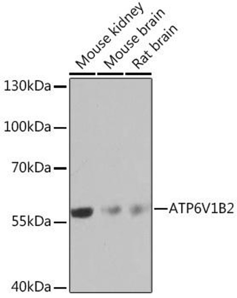 Signal Transduction Antibodies 3 Anti-ATP6V1B2 Antibody CAB16771