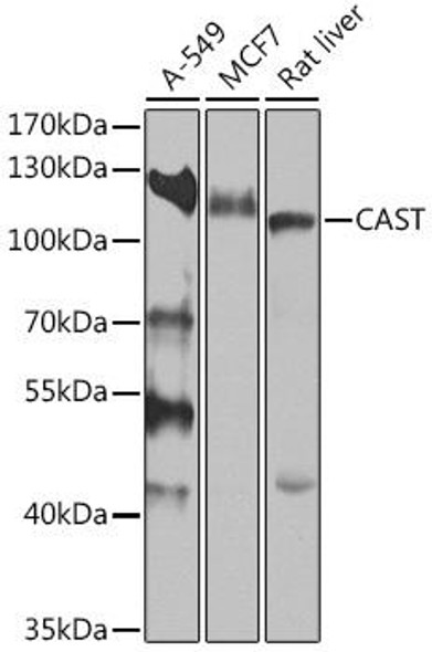 Cell Biology Antibodies 14 Anti-CAST Antibody CAB16791