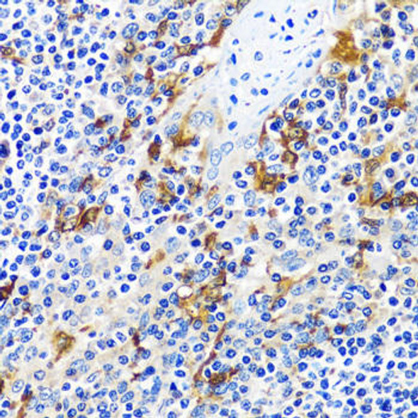 Cell Biology Antibodies 14 Anti-CASQ1 Antibody CAB16796