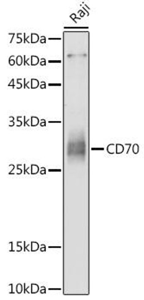 Cell Biology Antibodies 14 Anti-CD70 Antibody CAB16810