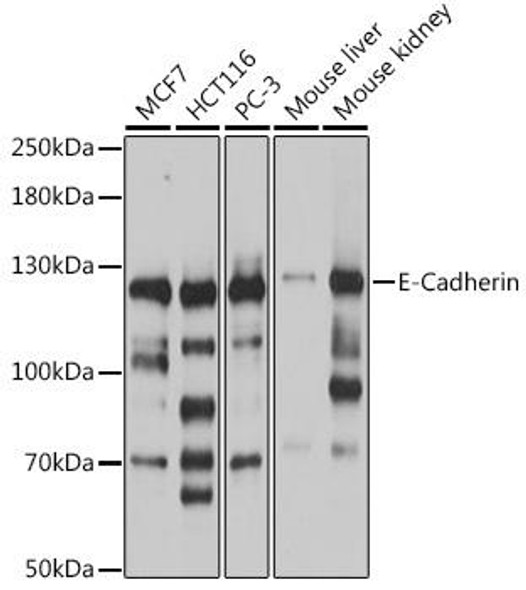 Cell Biology Antibodies 14 Anti-E-Cadherin Antibody CAB16811