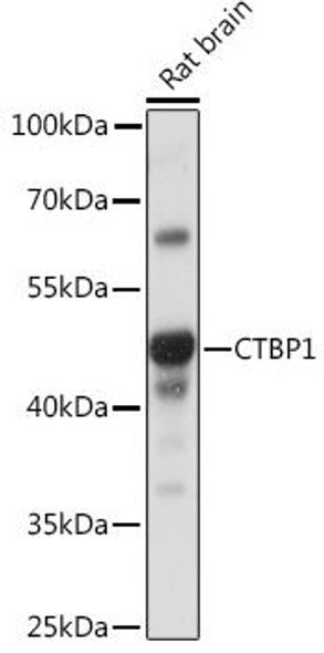 Developmental Biology Anti-CTBP1 Antibody CAB16825