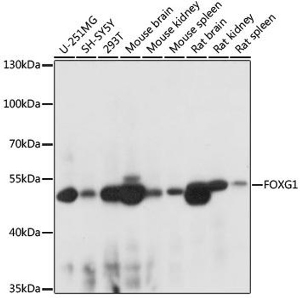 Cell Biology Antibodies 14 Anti-FOXG1 Antibody CAB16851