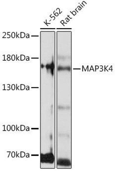 Cell Biology Antibodies 14 Anti-MAP3K4 Antibody CAB16918