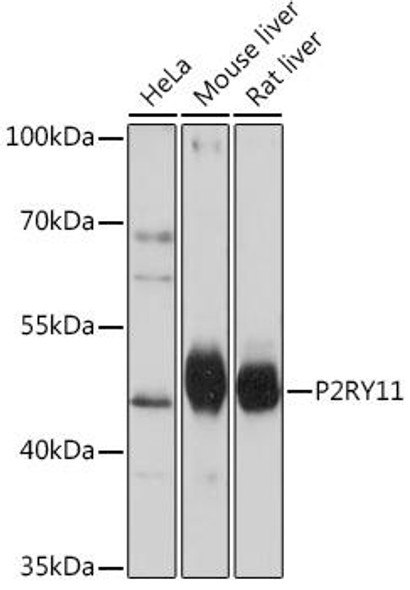 Cell Biology Antibodies 14 Anti-P2RY11 Antibody CAB16940