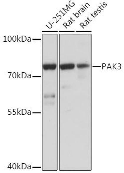 Cell Biology Antibodies 14 Anti-PAK3 Antibody CAB16942