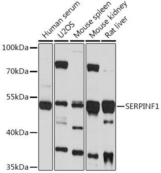 Cell Biology Antibodies 14 Anti-SERPINF1 Antibody CAB16945