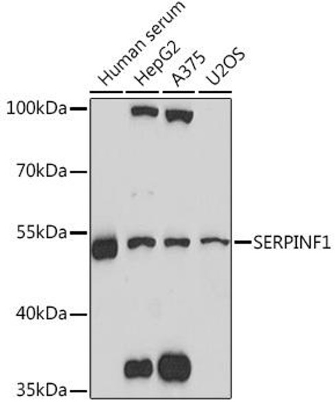 Cell Biology Antibodies 14 Anti-SERPINF1 Antibody CAB16946