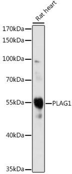 Cell Biology Antibodies 14 Anti-PLAG1 Antibody CAB16952