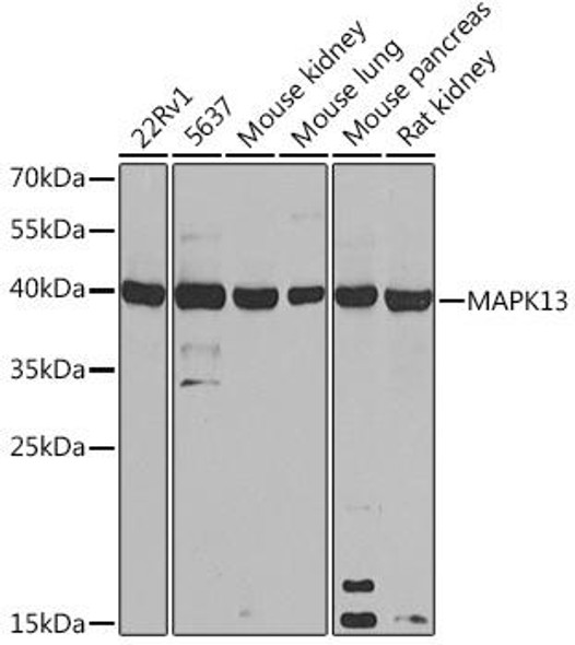 Cell Cycle Antibodies 2 Anti-MAPK13 Antibody CAB16961