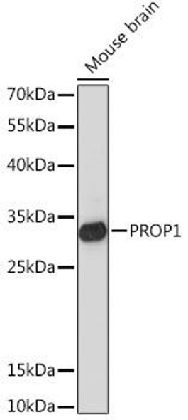 Cell Biology Antibodies 14 Anti-PROP1 Antibody CAB16963
