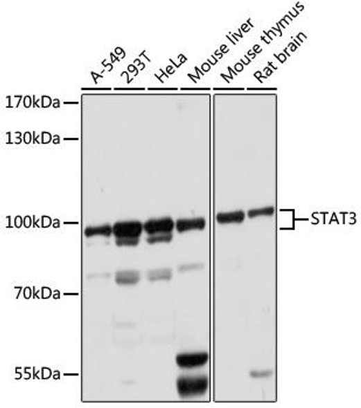 Immunology Antibodies 3 Anti-STAT3 Antibody CAB16975