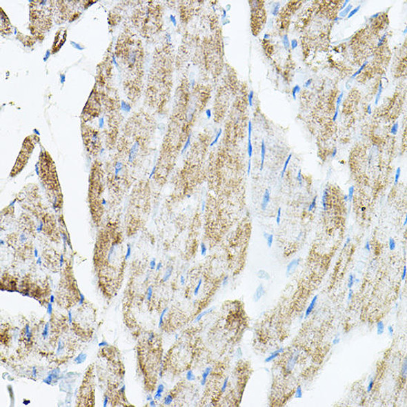 Cell Biology Antibodies 14 Anti-VEGFB Antibody CAB17001