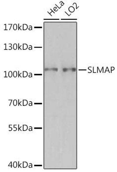 Cell Biology Antibodies 14 Anti-SLMAP Antibody CAB17013