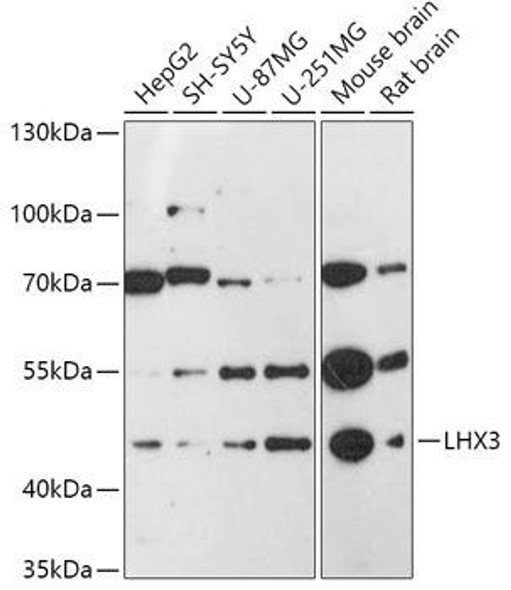 Cell Biology Antibodies 14 Anti-LHX3 Antibody CAB17015