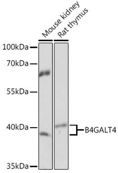 Cell Biology Antibodies 14 Anti-B4GALT4 Antibody CAB17029