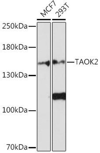 Cell Biology Antibodies 14 Anti-TAOK2 Antibody CAB17048
