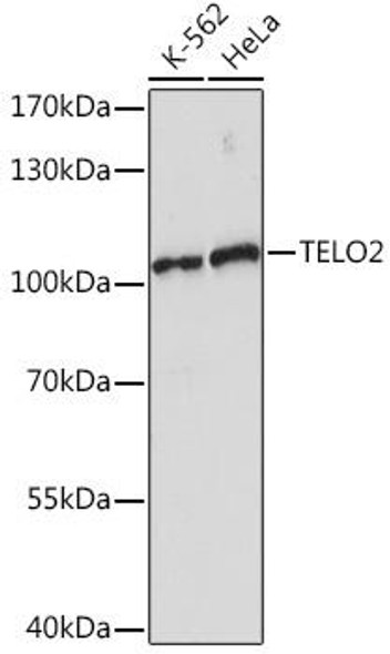 Cell Biology Antibodies 14 Anti-TELO2 Antibody CAB17064