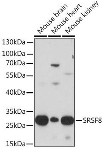 Cell Biology Antibodies 14 Anti-SRSF8 Antibody CAB17090