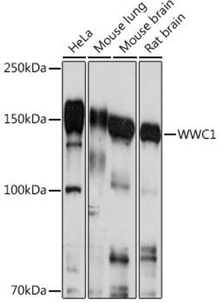 Cell Biology Antibodies 13 Anti-WWC1 Antibody CAB17110