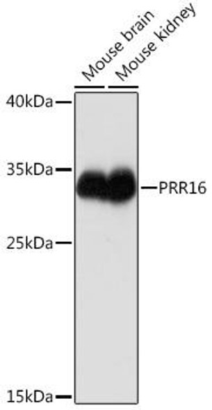 Cell Biology Antibodies 13 Anti-PRR16 Antibody CAB17155