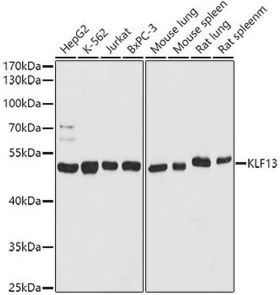 Western blot analysis of extracts of various cell lines, using KLF13 antibody at 1:1000 dilution. Secondary antibody: HRP Goat Anti-Rabbit IgG (H+L) at 1:10000 dilution. Lysates/proteins: 25ug per lane. Blocking buffer: 3% nonfat dry milk in TBST. Detection: ECL Basic Kit. Exposure time: 3s.