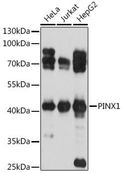 Cell Biology Antibodies 13 Anti-PINX1 Antibody CAB17172