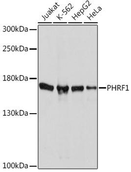 Cell Biology Antibodies 13 Anti-PHRF1 Antibody CAB17192