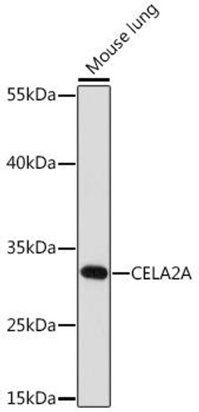 Cell Biology Antibodies 13 Anti-CELA2A Antibody CAB17200