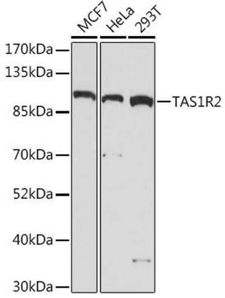 Cell Biology Antibodies 13 Anti-TAS1R2 Antibody CAB17218