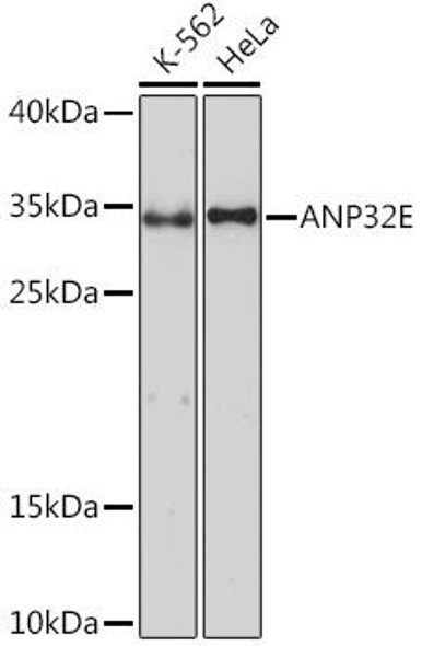 Cell Biology Antibodies 13 Anti-ANP32E Antibody CAB17220